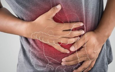 Irritable Bowel Syndrome: The Ins and Outs of Colon Health