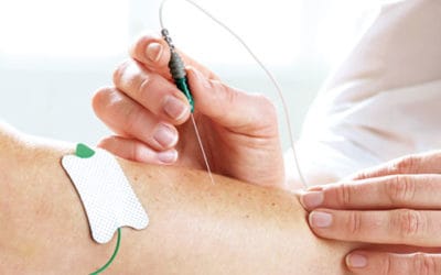 Contraction Connections