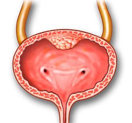 How to Improve Bladder Health