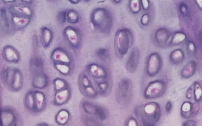 Connective tissue disorders and pelvic floor muscle dysfunction: Is there a connection? Part I