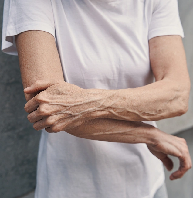 What is Multiple Sclerosis